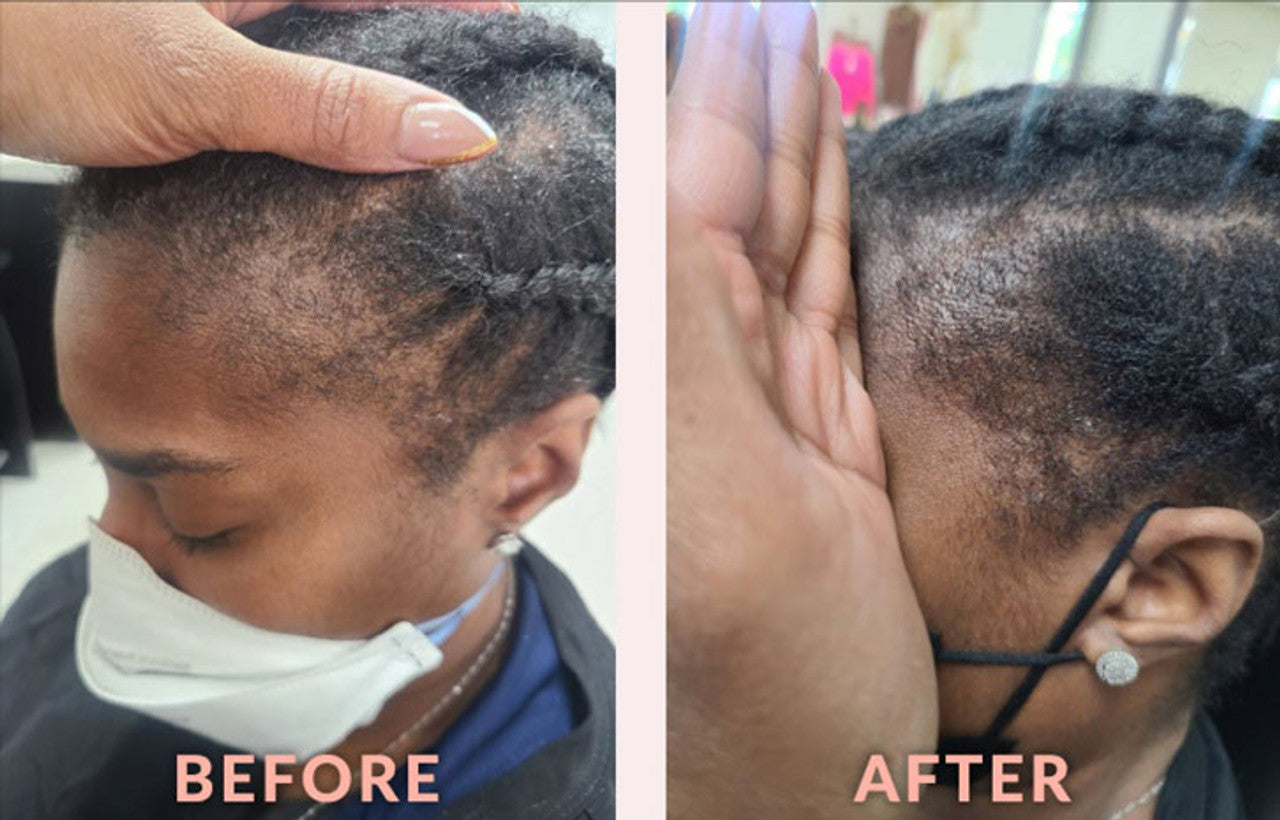 DESIGN ESSENTIALS Scalp Care Edge & Temple Strengthening Oil (4oz)