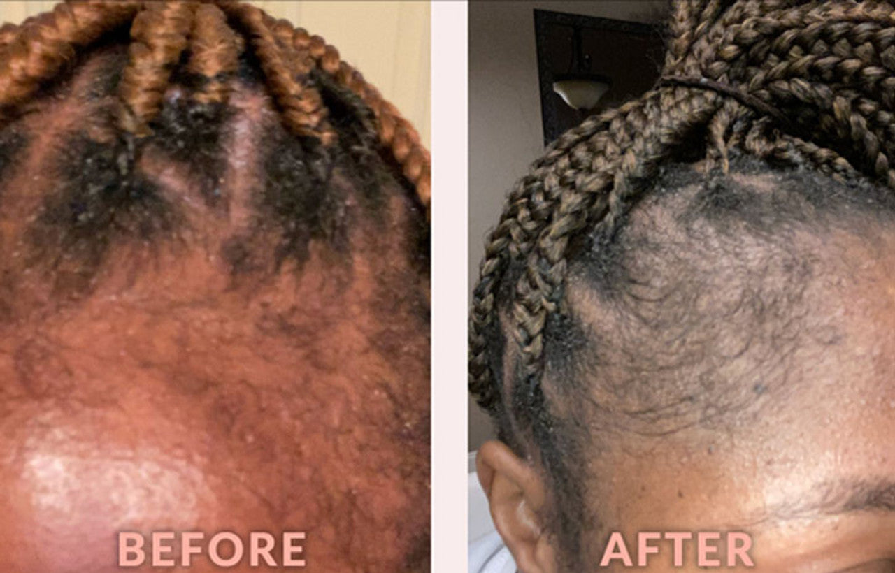 DESIGN ESSENTIALS Scalp Care Edge & Temple Strengthening Oil (4oz)